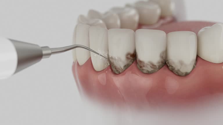 Reliable Dental Implants contractor in Farmington, MO by Smile Center Dentistry